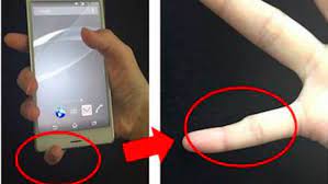 Bila asi tidak segera dikeluarkan maka terjadi tegangan alveoli yang berlebihan dan mengakibatkan sel epitel yang memproduksi asi menjadi datar dan tertekan, sehingga permeabilitas jaringan ikat meningkat. 5 Kelainan Aneh Gara Gara Kelamaan Pegang Ponsel Mulai Banyak Penderitanya Nih