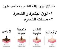وجدان فاشن on twitter أما الشعر الوبري الخفيف ماي نصح بإستخدام الليزر له لأن بعد الليزر بيكون سميك وقاسي أفضل طريقة له هي الحلاقة لكن بنفس الطريقة الي ذكرتها هنا https t co iazirqhw6g