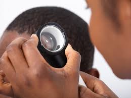 Skin malignancies are the most common cancer in the united states, responsible for more than half of all new cancer cases. Skin Cancer On Scalp Overview And More
