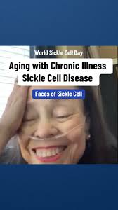80 years old with #sicklecell disease! 🥹 We’re starting  #WorldSickleCellDay off with our first #FacesofSickleCell feature, Pat  McGill. When we say she is an absolute gem…, Life expectancy for sickle ...