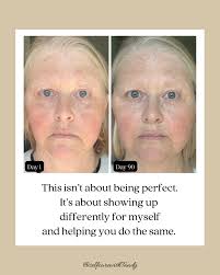 Did you know there's a safer, more effective alternative to retinol? Meet  Bidens Pilosa—a plant-based bio-retinol that transforms your skin without  the irritation. 🌿 Here's why else it's a game-changer: ✨ Reduces