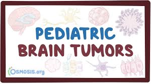 During may, we honor brain tumor awareness month, to raise awareness of childhood brain tumors and the significant need for more research that will lead to. Pediatric Brain Tumors Osmosis