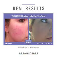 Angie Spear-Rodan+Fields Independent Consultant