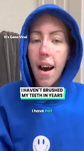 I Haven't Brushed My Teeth In Years