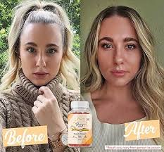 Amazon.com: Bronze Bites Tanning Gummies for Women & Men, Natural Skin  Tanning Supplement with Vitamin C, Astaxanthin & Beta Carotene