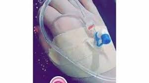 قضية الأبوين بين جيليك صور كانونه psidiagnosticins com