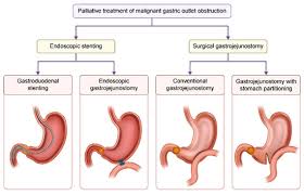 Image result for Succussion Splash