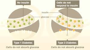 Der diabetes mellitus typ 2 hat andere ursachen als der typ 1 diabetes. Diabetes Typ 2 7 Symptome 1 Ursache Und 29 Tipps