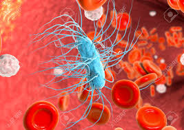 Cushing ulcers are associated with a brain tumor or injury and typically are single, deep ulcers that are prone to perforation. Escherichia Coli Bakterium Im Blut 3d Darstellung Sepsis Bakteriamie Lizenzfreie Fotos Bilder Und Stock Fotografie Image 66214353