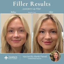 Bambi Lynn Parnell (@injectorbambi) • Instagram photos and videos