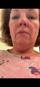 Any reviews for Dr Berat , Antalya welcomed TIA