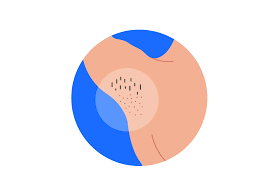 The easiest way to soften and condition pubic hair is to use a hair conditioner that is free from flavor, fragrance, and alcohol. Loss Of Armpit Pubic Hair Symptoms Causes Common Questions Buoy
