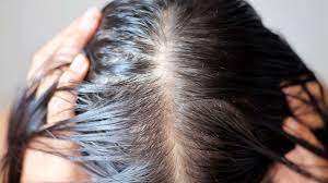 Need hair loss information and treatments? 12 Signs Of Hair Loss To Bring Up To Your Dermatologist Abc News