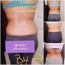 Pin On Cavitation