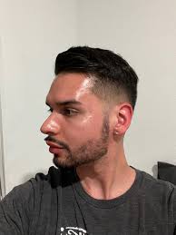 Zo Skin Health Brightalive Before and After