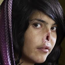 Victor Davis Hanson: The Left's selective outrage