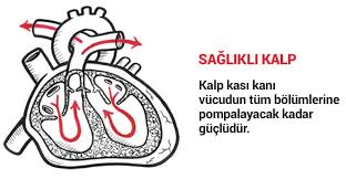 Kalp Yetersizligi Nedir Ve Belirtileri Nelerdir Kalbinidinlesen Kalp Kalp Krizi