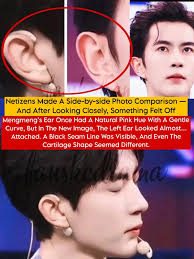 Mengmeng's alleged ear surgery sparks concern