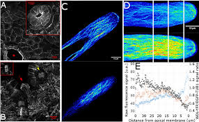 Informatica is a data processing tool that is widely used for etl to extract transform and load processing. Microtubule Associated Protein Wave Dampened2 Like Wdl Controls Microtubule Bundling And The Stability Of The Site Of Tip Growth In Marchantia Polymorpha Rhizoids