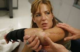 Attack victim suffers through health-care limbo