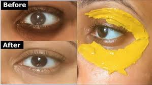 Why You Should Apply A Turmeric Mask Around The Eyes Kecantikan