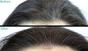 Blackening Hair Oil For Grey Hair To Turn Black Or Darker Etsy Unwanted Hair Removal Hair Regrowth Women Natural Hair Styles