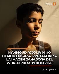La fotógrafa palestina Samar Abu Elouf fue galardonada con el premio Foto  del Año del World Press Photo 2025, por una potente imagen que retrata a  Mahmoud Ajjour, un niño de 9