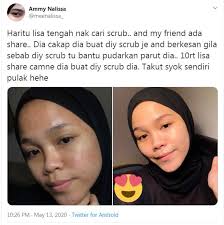 Cara menghilangkan jerawat dalam sekejap memang tidak mudah, dan tentunya kalau ada sangat diinginkan oleh setiap orang yang memiliki masalah pada wajah mereka. Gadis Ini Kongsi Cara Buat Skrub Hilangkan Parut Jerawat Hanya Guna Pencuci Muka Gula Halus Hijabista