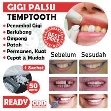 We did not find results for: Penambal Gigi Berlubang 50 Butir Temptooth Gigi Palsu Lem Gigi Padat Lem Gigi Berlubang Shopee Indonesia