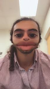 Tyler Spurgeon Edmonton