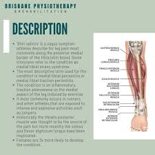 Image result for Shin Splints