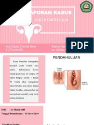 We did not find results for: Kist Brtli Pdf