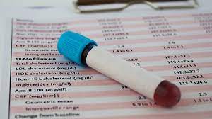 Maybe you would like to learn more about one of these? How To Cheat A Cholesterol Test