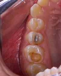 Dentista en Chilpancingo Bautista Dental