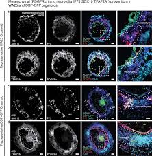 Induction of surface ectoderm and CNC cells in WA25 and DSP-GFP skin... |  Download Scientific Diagram