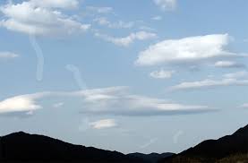 Check spelling or type a new query. Eye Floaters After Eye Surgery