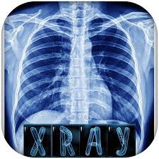 With the item you can show all ores in a . X Rays App Store Keywords Research Case Asotools
