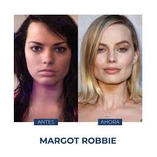 MargotRobbie es una de las estrellas de Hollywood más atractivas que  conocemos hoy en día. Su rostro ha tenido una gran evolución gracias a la  #bichectomia, #rinoplastía y #cantopexia, mismas que le
