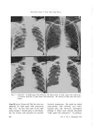 Image result for Pseudoeriosema
