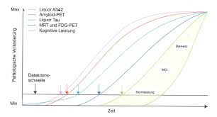 Thomas fritsch (born 16 january 1944 in dresden, germany) is a german television and dubbing actor. Alzheimer S Disease Iason Alzheimer S Disease Early Detection Entrainment