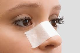 Check spelling or type a new query. Recovery After Nose Surgery Rhinoplasty What To Expect