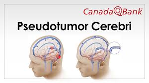 Image result for Pseudoeriosema