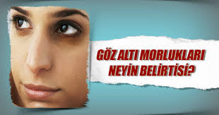 Goz Alti Morluklari Neyin Belirtisi Saglik Haberleri