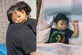 Dalam hal ini, tonsil anak terletak pada bahagian belakang kerongkongnya. Demam Berlarutan Bapa Terkejut Google Simptom Kawasaki Selepas 5 Hari Anak Di Wad Sedih Dia Terpaksa Makan Ubat Jantung Orang Dewasa Viral Mstar