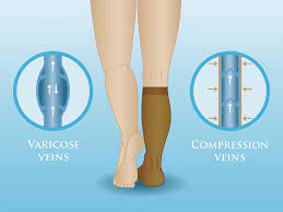 Compression Socks And Stockings May Seem Uncomfortable But