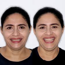 Dento Duo (@dentoduo_envigado) • Instagram photos and videos