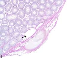 On the posterior edge and superior pole of the testis is a structure called the epididymis. Testis Nonneoplastic Lesion Atlas