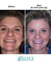 Elice Dental Care