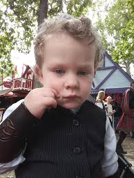 Day after Festival kilt leg's lol. Poor thing