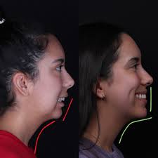 Dr. David Alfi DDS MD FACS (@dr.davidalfi) • Instagram photos and videos